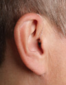 RIC Hearing Aid